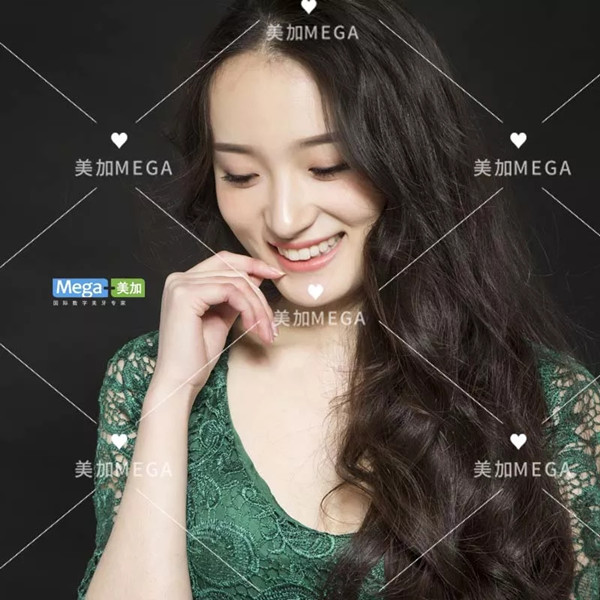 美牙故事:牙齿缝隙已经是BUG了,还牙齿发黄,这样的妹子怎么办?