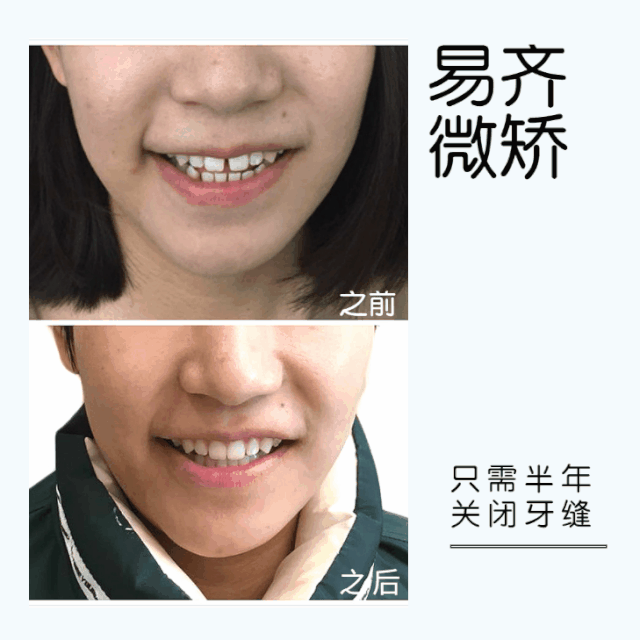 易齐微矫案例