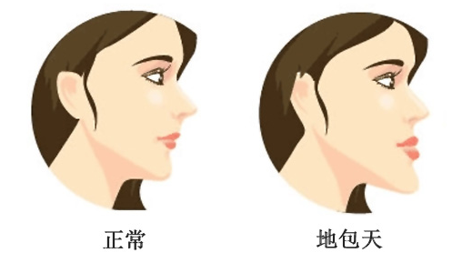正文图片