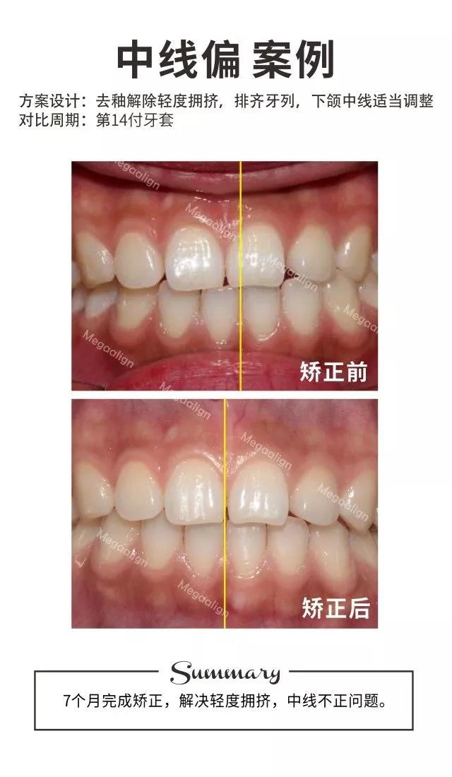 正文图片