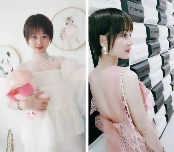 戴隐形牙套前需要注意什么?戴前必看!