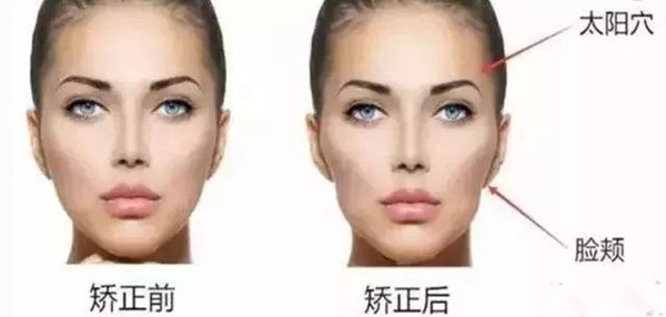 牙套脸怎么办呢?