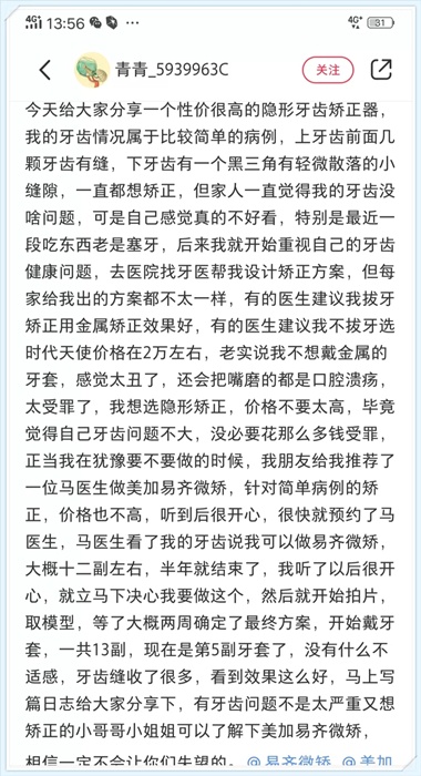 给正犹豫做牙齿矫正的你,看完就知道怎么选了