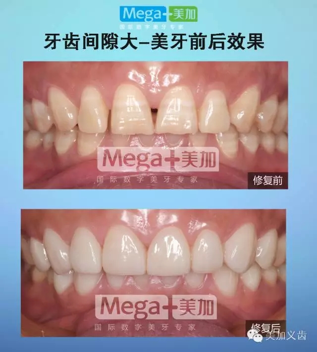 正文图片