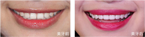 正文图片