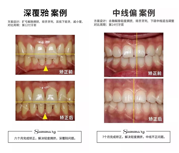 易齐微矫案例