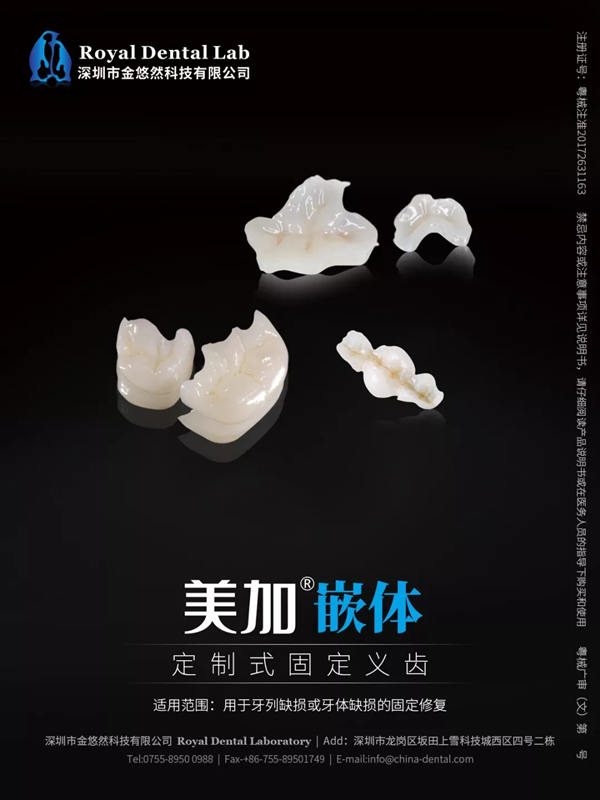 美加嵌体