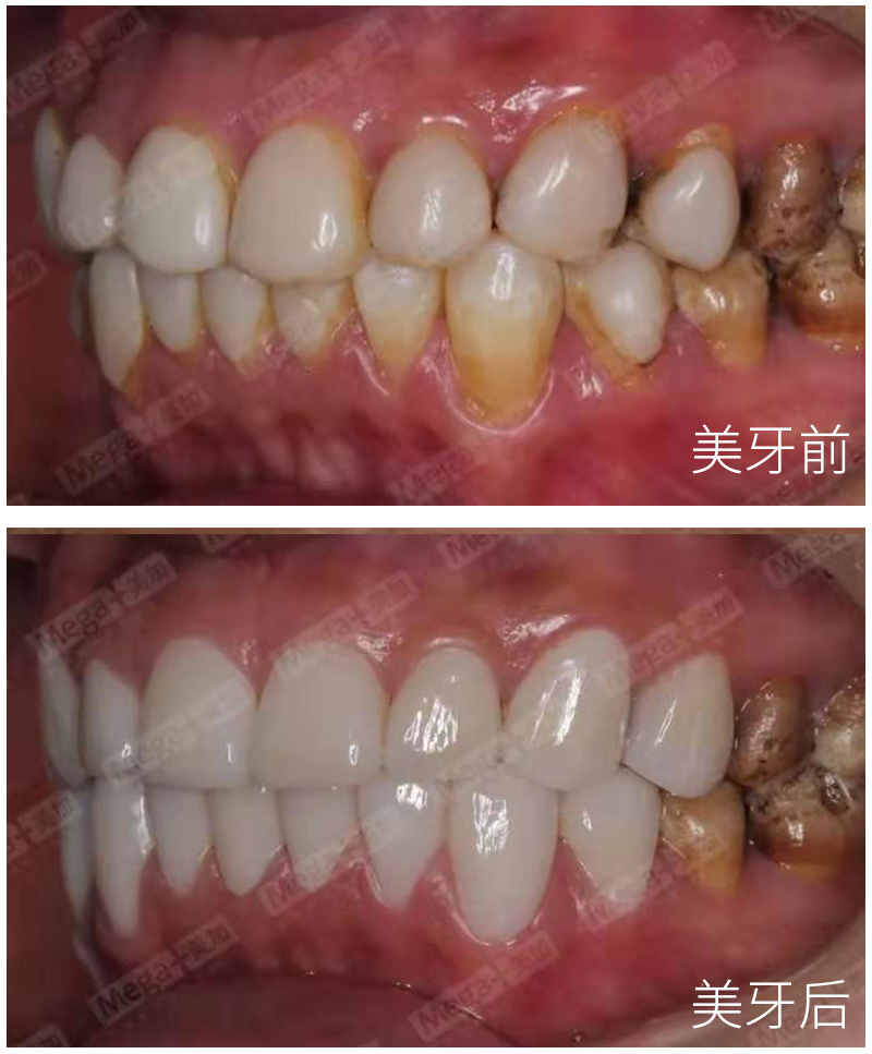 正文图片