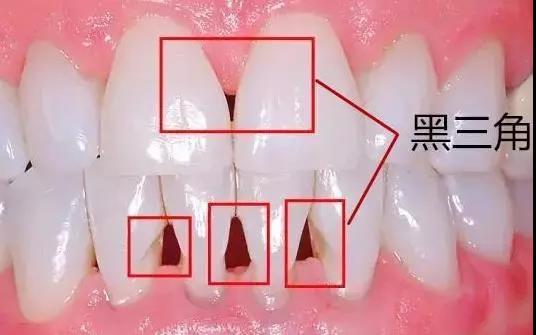 正文图片
