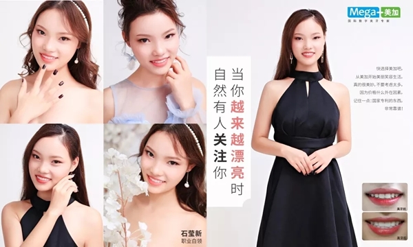 阳光笑容有bug,没关系,美加贴面来帮你