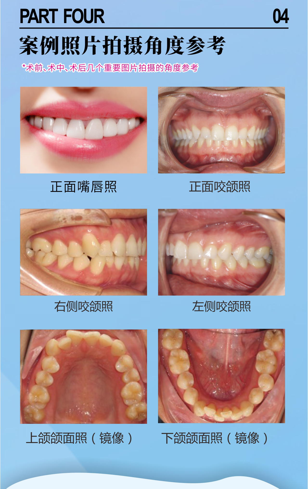 正文图片