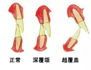 正文图片