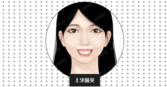 牙齿适应症