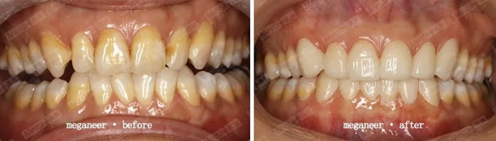 修复效果前后对比