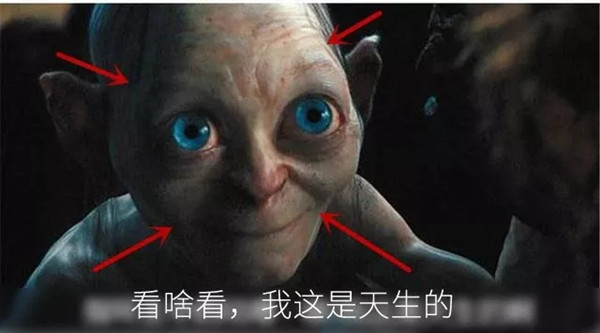 “牙套脸”是啥?为什么矫正牙齿的人都害怕