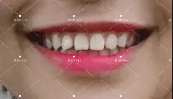正文图片