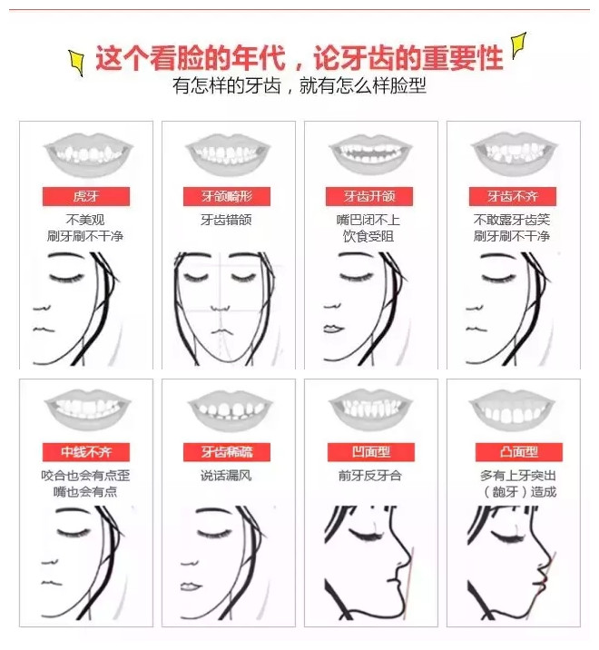 为什么现在越来越多的人做牙齿矫正?