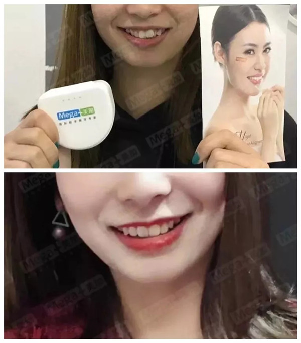 就问你服不服牙齿整齐的重要性~