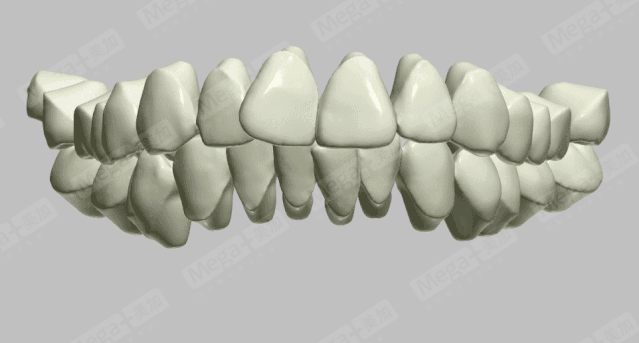 矫正3D效果预览