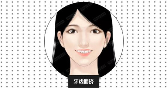 牙齿适应症