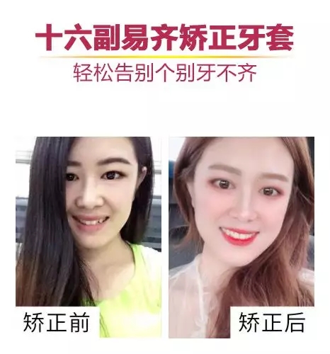矫正心得:这位易齐矫正顺利毕业的盆友有话要分享大家