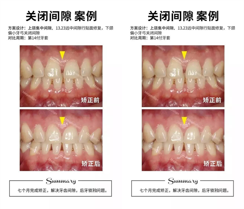 易齐微矫案例