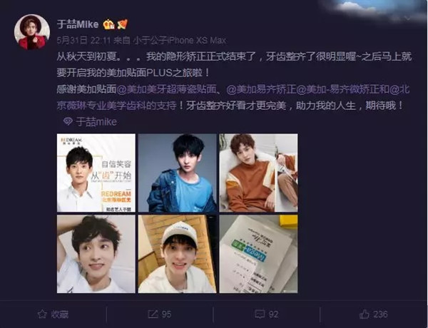 于喆隐形矫正大成功!变更帅的他,发展更顺!期待他更多作品!