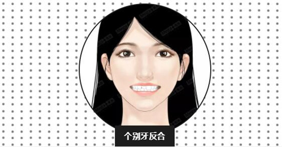 牙齿适应症