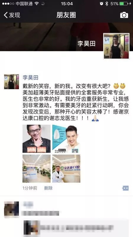 自信露齿,美加美牙贴面让他成为那个更好的自己!
