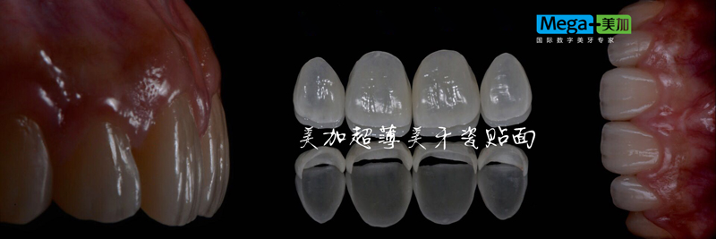 正文图片