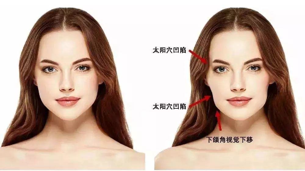 正文图片