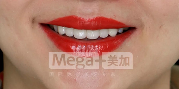 涂上口红后,国际笑容的即视感。
