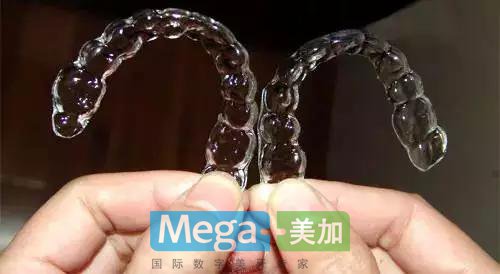 隐形矫正是怎么样的