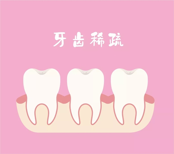 牙齿天生稀疏,怎么办?