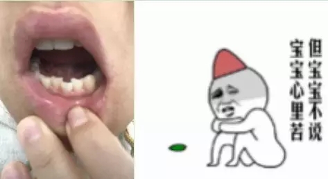 牙齿矫正后会反弹是怎么回事呢?