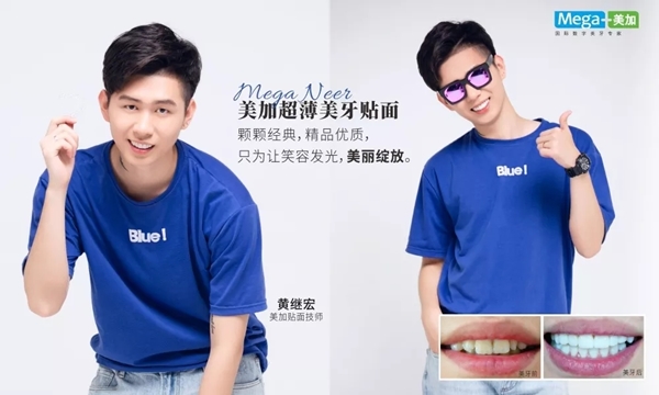 阳光笑容有bug,没关系,美加贴面来帮你