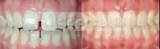 正文图片