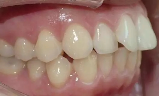 易齐微矫怎么样?这份体验报告给你