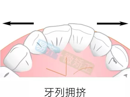 正文图片