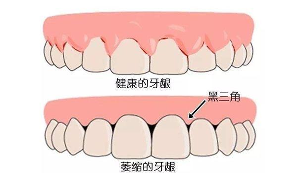 正文图片