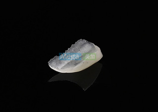 超薄瓷贴面