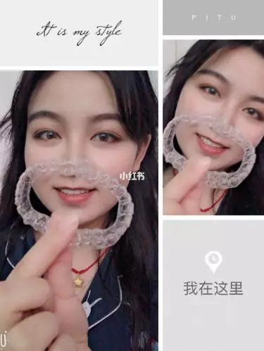 美加用户分享:中线不齐的我,易齐微矫后轻松变齐