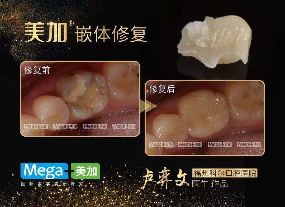 正文图片