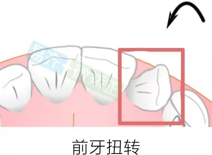 正文图片