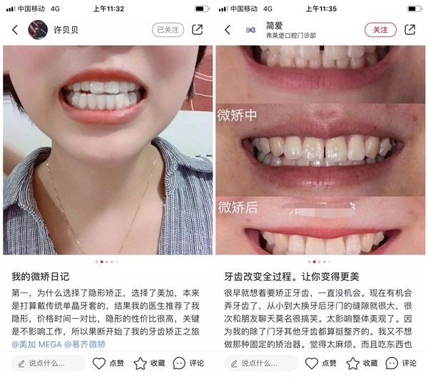 颜即正义时代,原来他们的“牙值”都是这样提升的