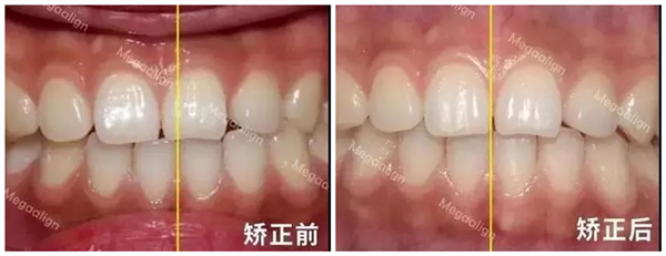 正文图片