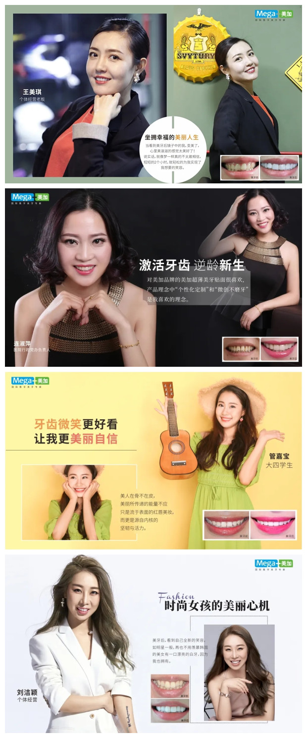 同样都叫瓷贴面,为什么她们都爱用美加的