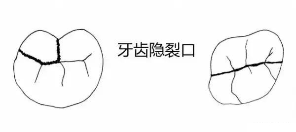 正文图片