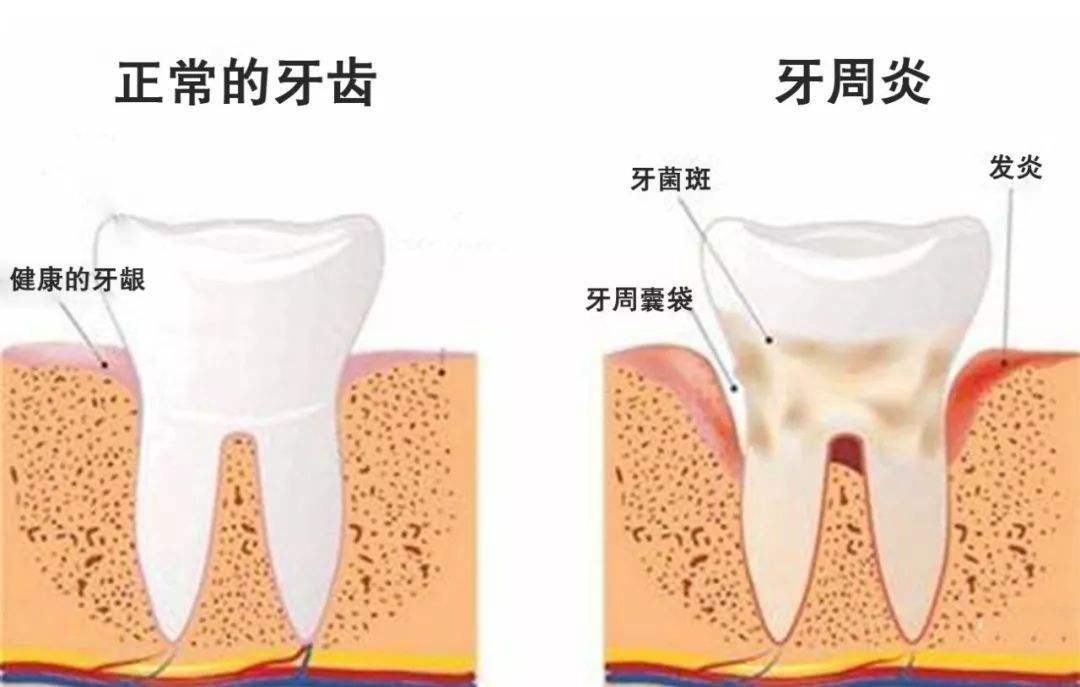 正文图片