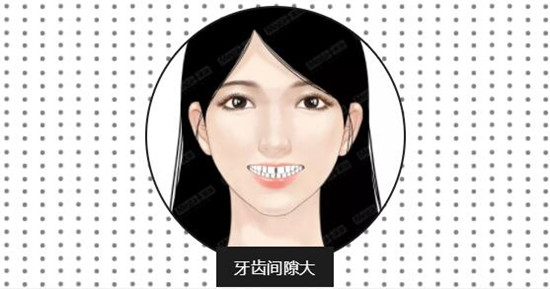 牙齿适应症